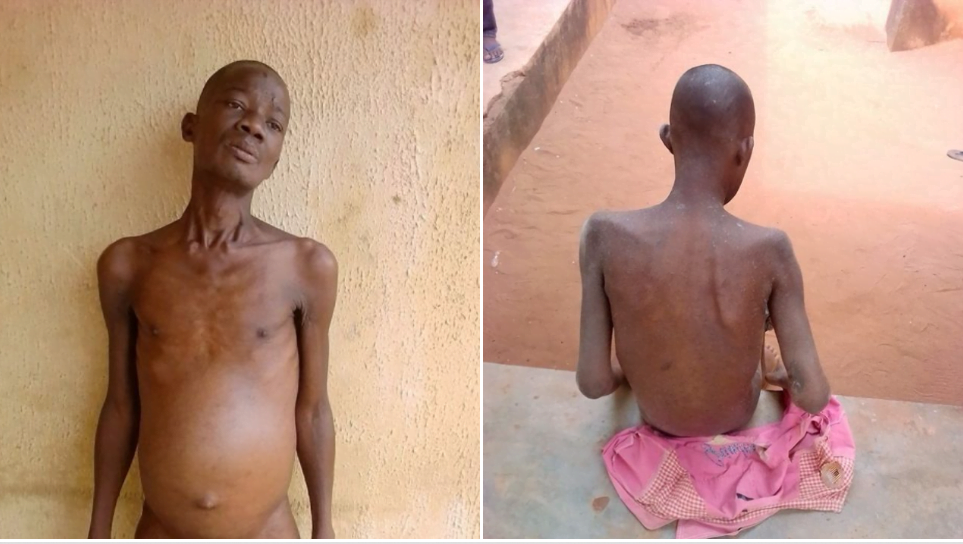 Photos: See shocking state of prisoners at Delta State prison