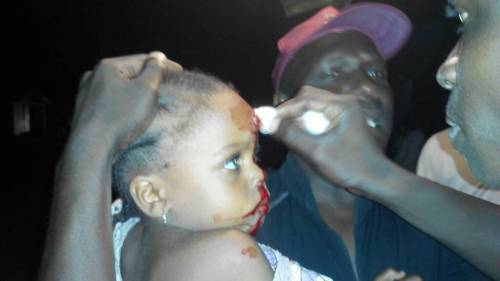 A young girl was wounded by a stray bullet after Boko Haram militants invaded Maiduguri