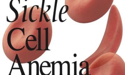 Sickle Cell Patients Should Take Water Often To Replace Lost Cells - Expert