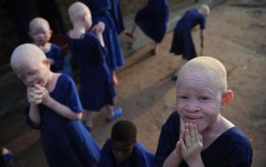 Five-Year-old Albino Girl, Kidnapped, Beheaded For Rituals In Mali