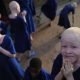 Five-Year-old Albino Girl, Kidnapped, Beheaded For Rituals In Mali