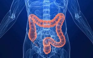 Colon Cancer Screening Should Begin At 45 – American Cancer Society