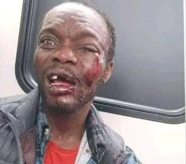 Anambra Bus Preacher Beaten To Coma After Condoms Fall From Bible (Photo)