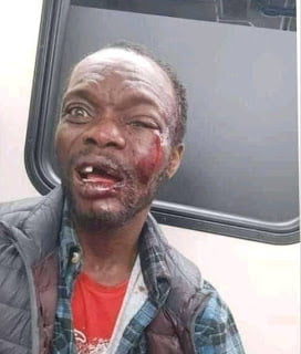 Anambra Bus Preacher Beaten To Coma After Condoms Fall From Bible (Photo)