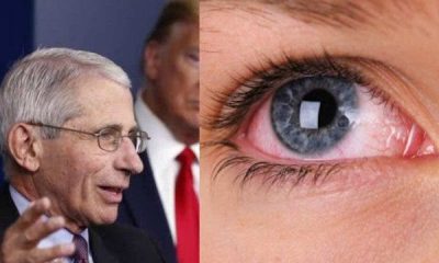 Dr Fauci Gives Important Advice Amid Evidence Coronavirus Can Get Into Eyes,