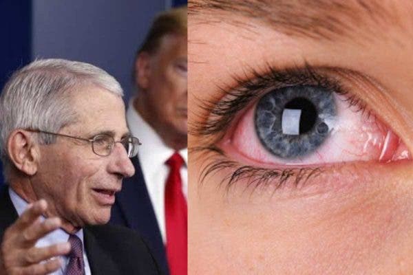 Dr Fauci Gives Important Advice Amid Evidence Coronavirus Can Get Into Eyes,