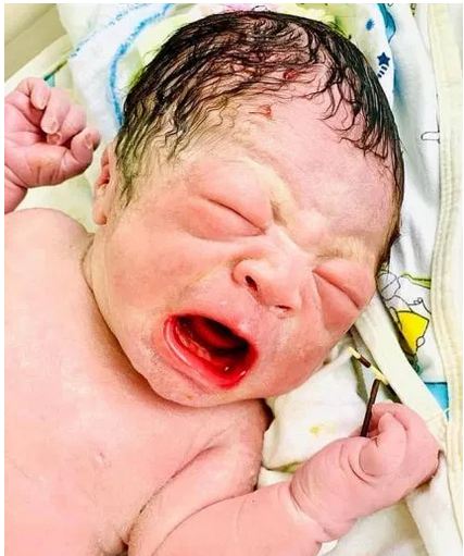 Newborn Baby Holds Contraceptive Coil The Mother Used To Avoid Pregnancy (Photos)