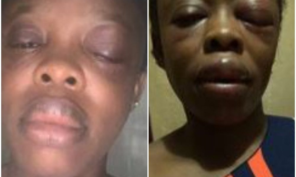 Lagos Teacher Lucky To Be Alive After Her Encounter With One-Chance Operators Photo