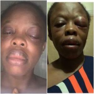 Lagos Teacher Lucky To Be Alive After Her Encounter With One-Chance Operators Photo