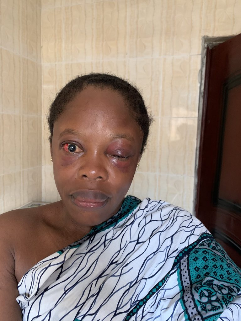 Lagos Teacher Lucky To Be Alive After Her Encounter With One-Chance Operators |Photo
