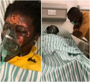 Man Disfigures Wife’s Face With Acid |Photos