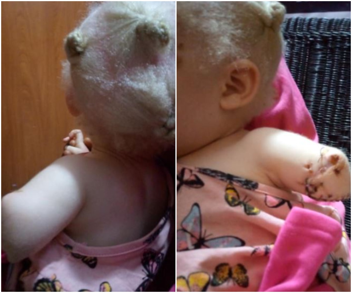 Toddler's Hand Chopped Off By Albino Hunters For Ritual