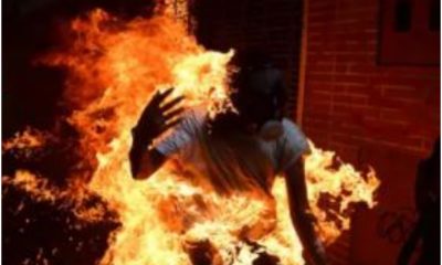 University Final Year Student Set On Fire For Refusing To Join Cult