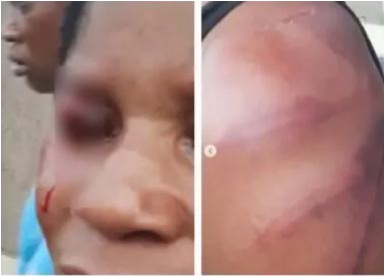 Man Arrested For Repeatedly Brutalizing His Wife Photos