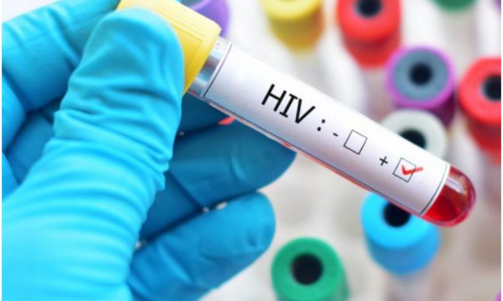 Taraba Govt Begins Mass Testing For HIV As 77 Persons Are Confirmed Positive