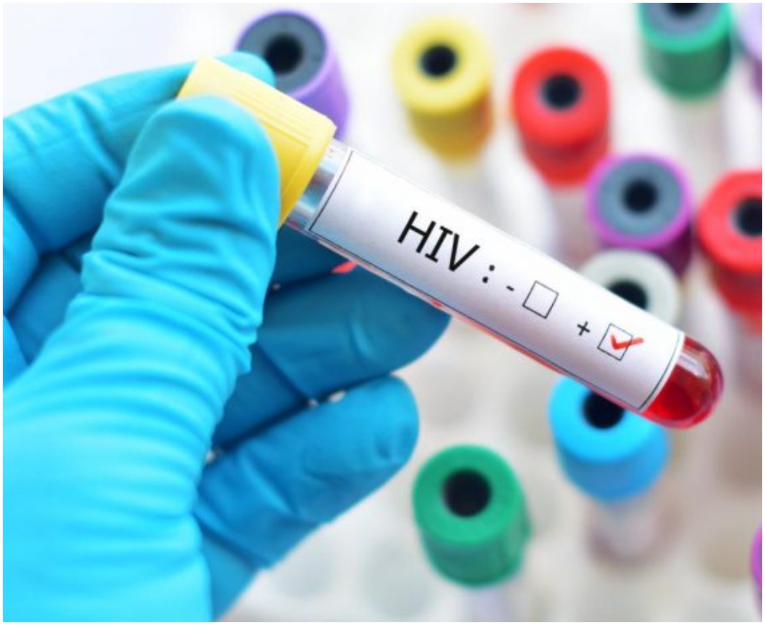 Taraba Govt Begins Mass Testing For HIV As 77 Persons Are Confirmed Positive