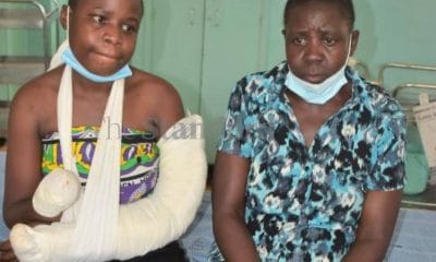 Leave Abuse Marriages - Woman Whose Husband Chopped Off Her Advises Others