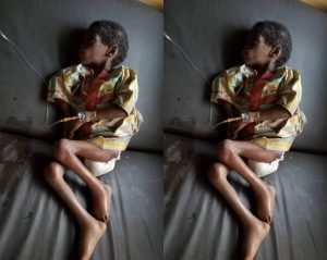 Osun Govt Rescues 7-Year-Old Girl Abused, Abandoned By Her Aunt