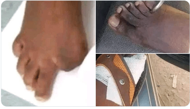 (REVEALED) Toe Cutting and Selling in Zimbabwe is a Fraternity (Money Ritual)