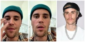 My Sickness Is Getting Worse - Justin Bieber Cries Out