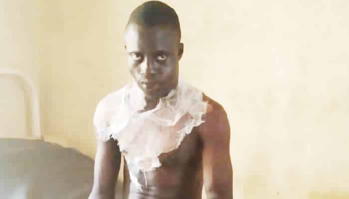 Man Sets Self Ablaze In Osun, Alleges Abuse By His Two Months Old Wife