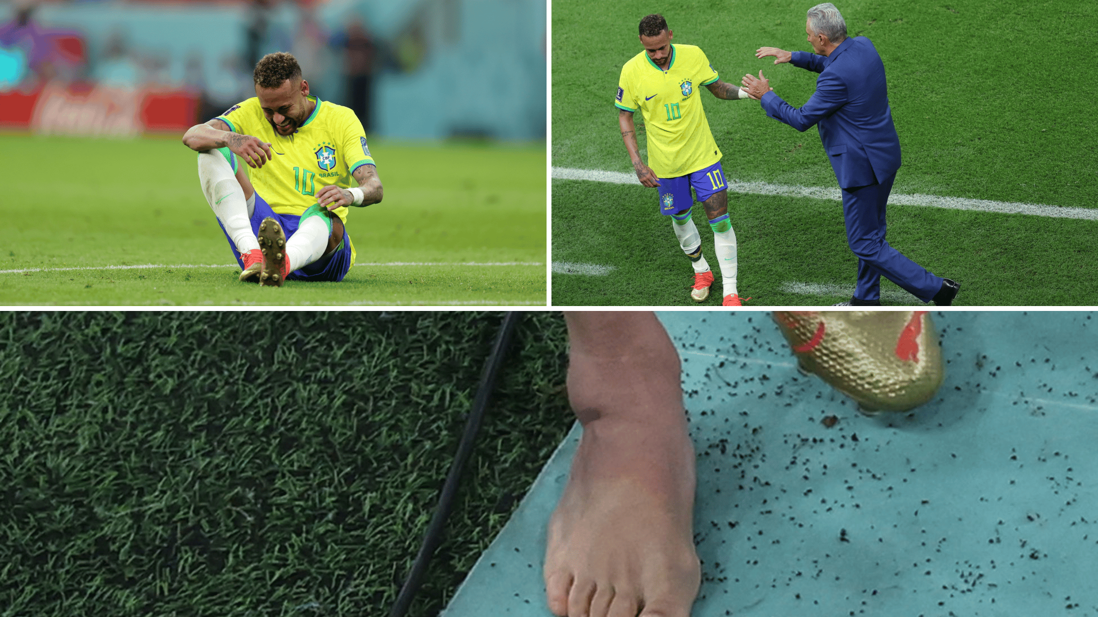 Neyamr's Injury may be big blow for Brazil