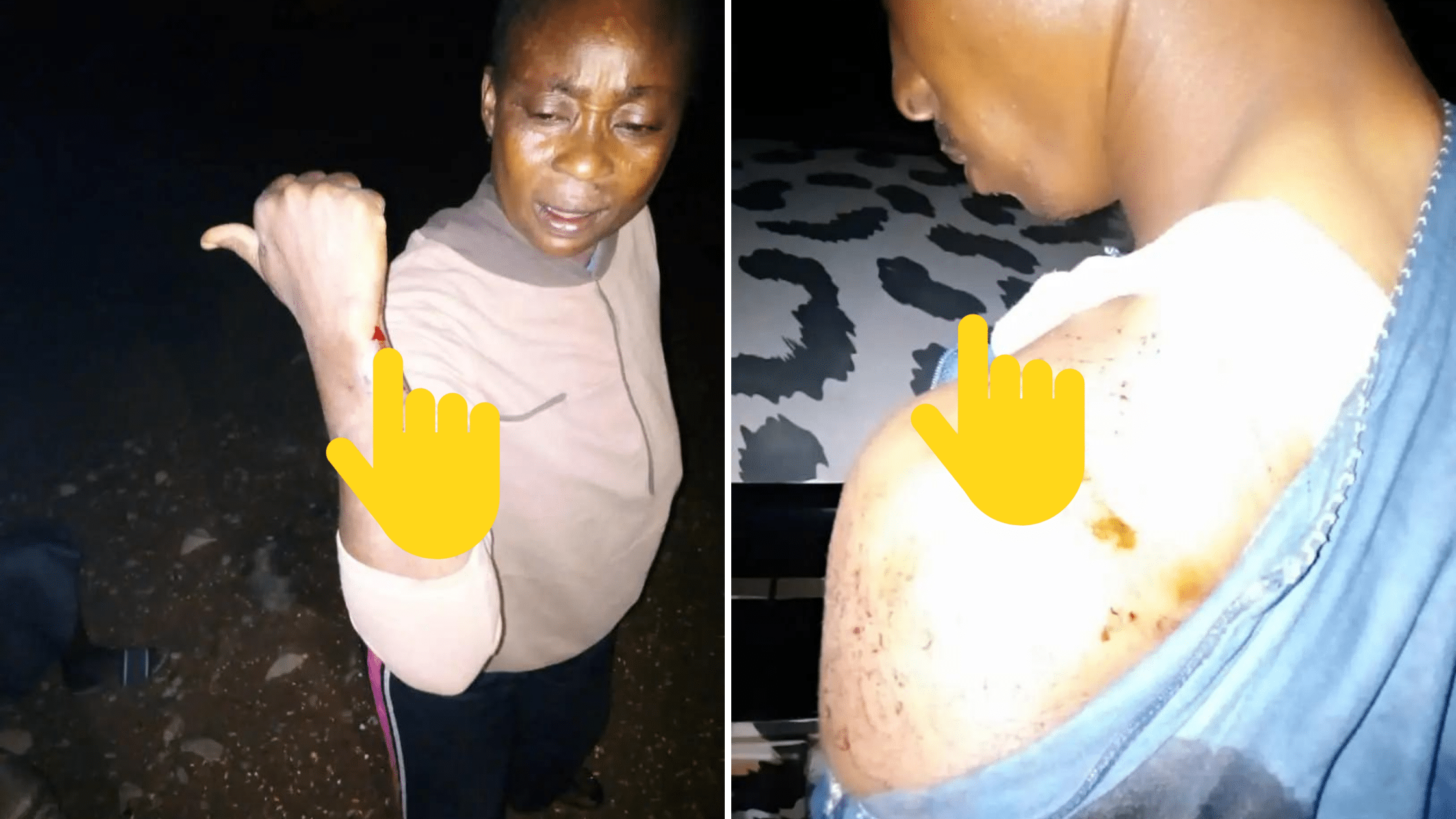 JUST IN: Scores Injured As APC, PDP Supporters Clash In Oyo - [Photos]