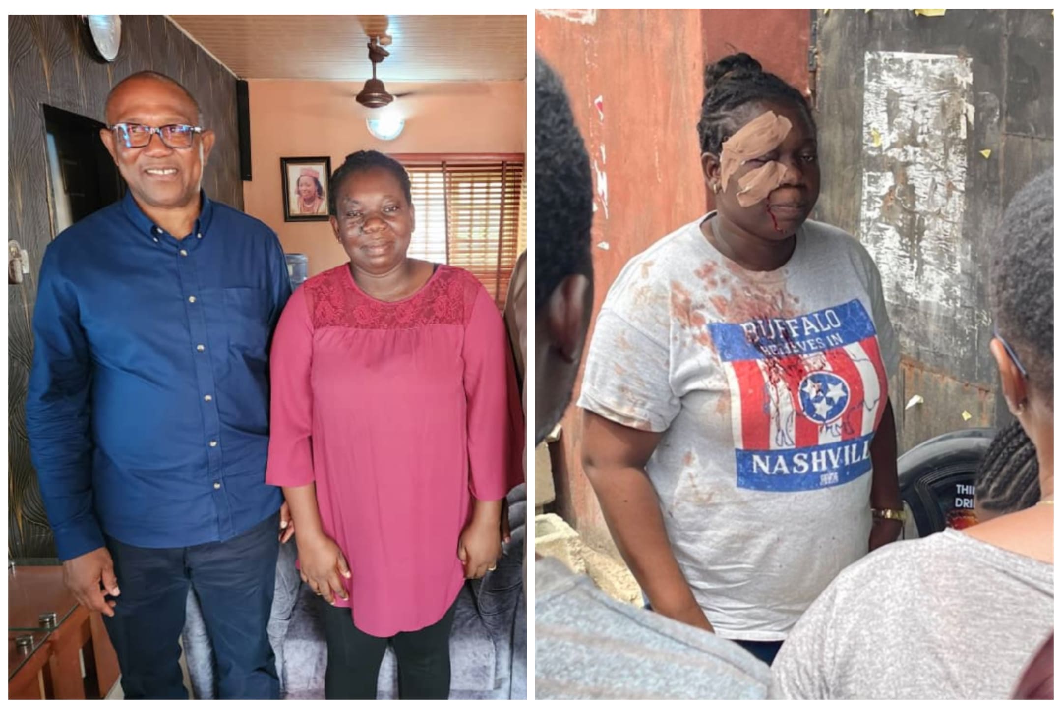 Watch How Peter Obi Responded To Emotional Request From Family Of Woman Attacked By Thugs During Presidential Election