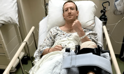 Mark Zuckerberg Undergoes Knee Surgery (Photos)