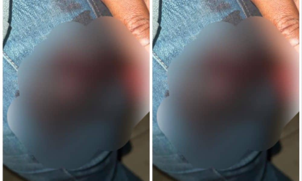 Man Escapes With Bullet Wound After Being Attacked By Suspected Kidnappers In Abuja
