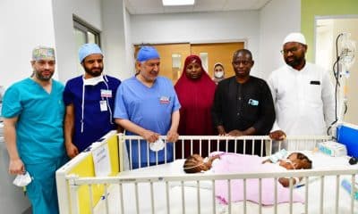 Saudi Medical Experts Successfully Separate Conjoined Twins From Kano