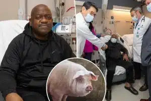 62-Year-Old Man Who Underwent First-Ever Modified Pig Kidney Transplant Is Dead