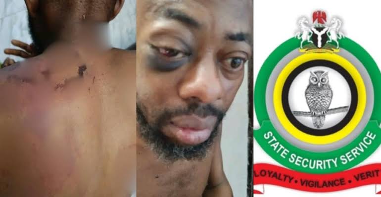 DSS Bars Family From Seeing Detained NANS Factional President Amid Health Concerns