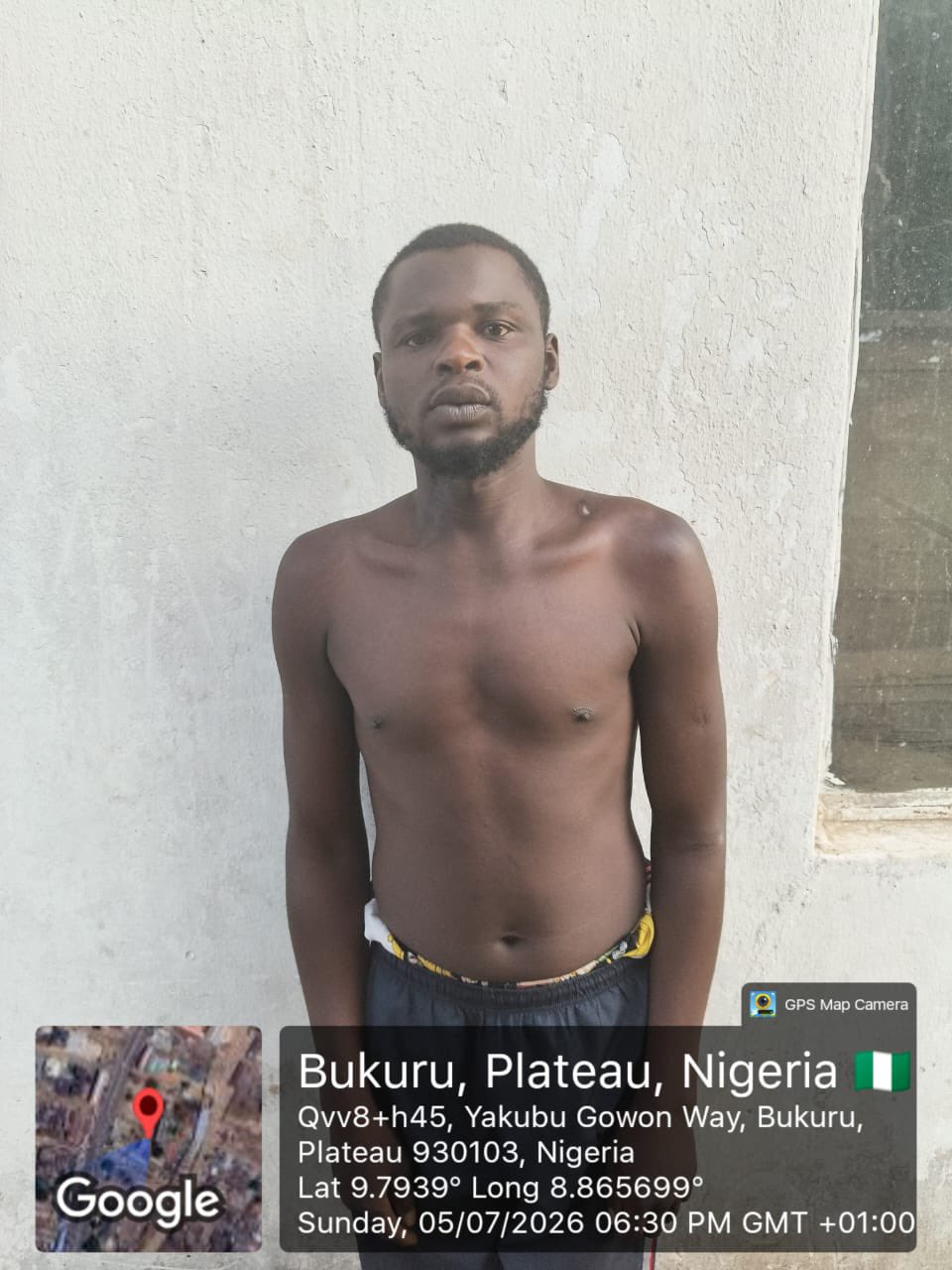 Photos: Troops Arrest NIPSS Attack Suspect Receiving Gunshot Treatment