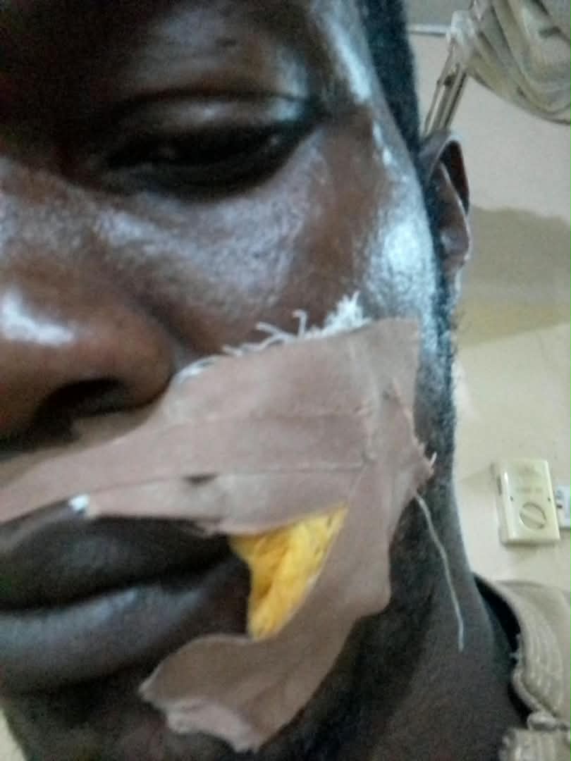 Tension As Gunmen Attack ADC Campaign Convoy In Edo, Supporter Shot [Photo]